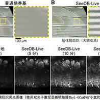九州大学等实现活体小鼠大脑透明化，在维持正常功能的同时进行荧光观察