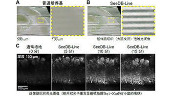 九州大学等实现活体小鼠大脑透明化，在维持正常功能的同时进行荧光观察