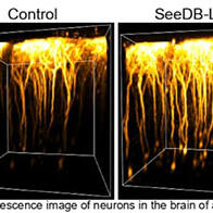 九州大学开发出可使活体组织透明化的试剂，防止光线折射和散射