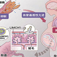 名古屋大学揭示早发型子痫前期发病机制，胎盘来源的细胞外囊泡蛋白参与疾病进程