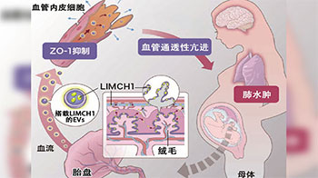 名古屋大学揭示早发型子痫前期发病机制，胎盘来源的细胞外囊泡蛋白参与疾病进程
