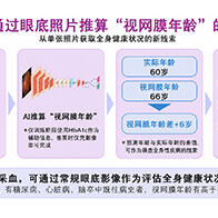 日本东北大学的AI技术，仅用一张眼底照片即可推算出反映身体年龄的“视网膜年龄”