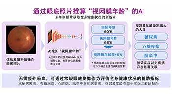 日本东北大学的AI技术，仅用一张眼底照片即可推算出反映身体年龄的“视网膜年龄”