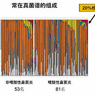 福井大与筑波大发现真菌参与嗜酸性鼻窦炎恶化，感染链格孢菌复发风险升至2.8倍