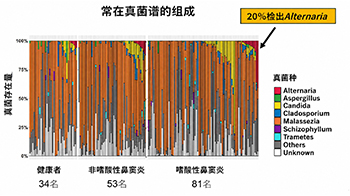 福井大与筑波大发现真菌参与嗜酸性鼻窦炎恶化，感染链格孢菌复发风险升至2.8倍