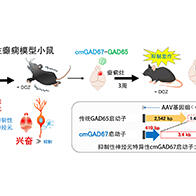 群马大学开发针对难治性癫痫的新型基因疗法，利用超小型GAD67启动子抑制发作