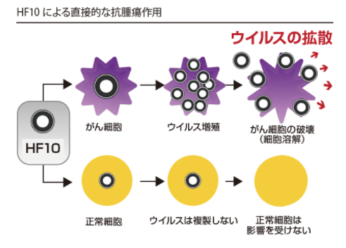 “以毒攻毒”--癌症病毒疗法在日本逐步走进临床