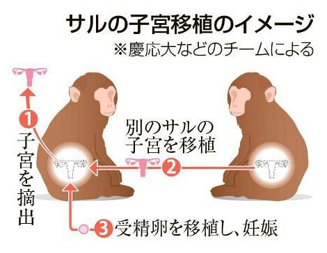 猕猴子宫移植试验示意图