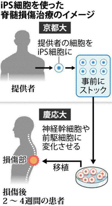 脊髓损伤iPS修复流程示意图