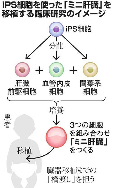 日本ips细胞研究报告 廿六 横滨市大篇 肝芽移植临床申请 客观日本