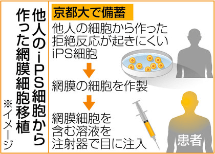 日本iPS细胞研究报告(廿九) 理研篇：确认视网膜移植试验安全性