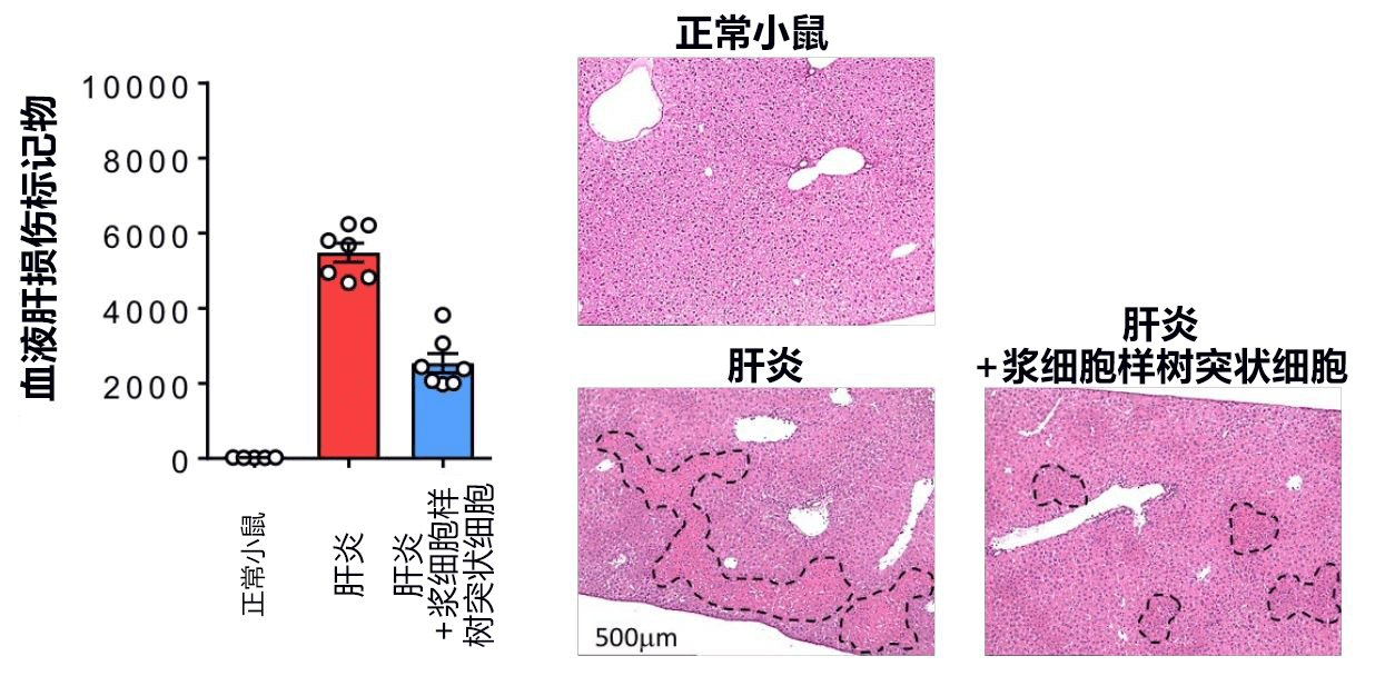 日本发现控制急性肝衰竭的新型免疫细胞，有望开发新治疗方法