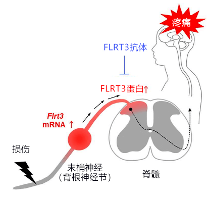 大阪大学确定FLRT3蛋白质会加剧神经性疼痛的疼痛感