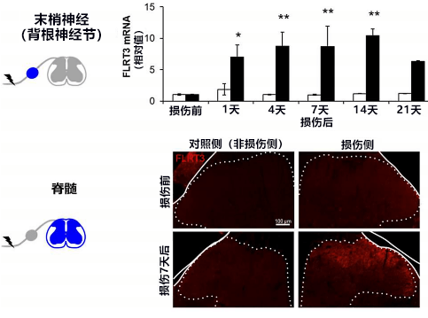 大阪大学确定FLRT3蛋白质会加剧神经性疼痛的疼痛感