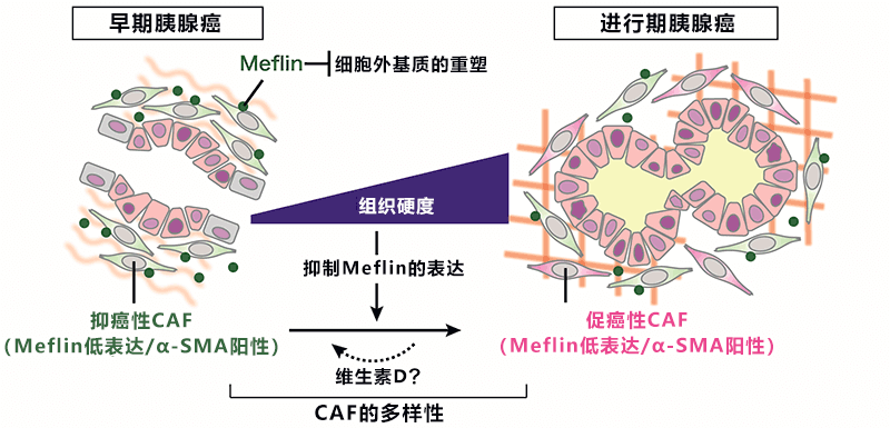 日本发现抑制胰腺癌恶化的新型细胞，有望开发改变癌细胞周围环境的新疗法